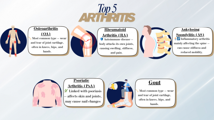 Top 5 types of arthritis | Physiotherapy knee pain treatment at Wellness Philosophy clinic in Singapore