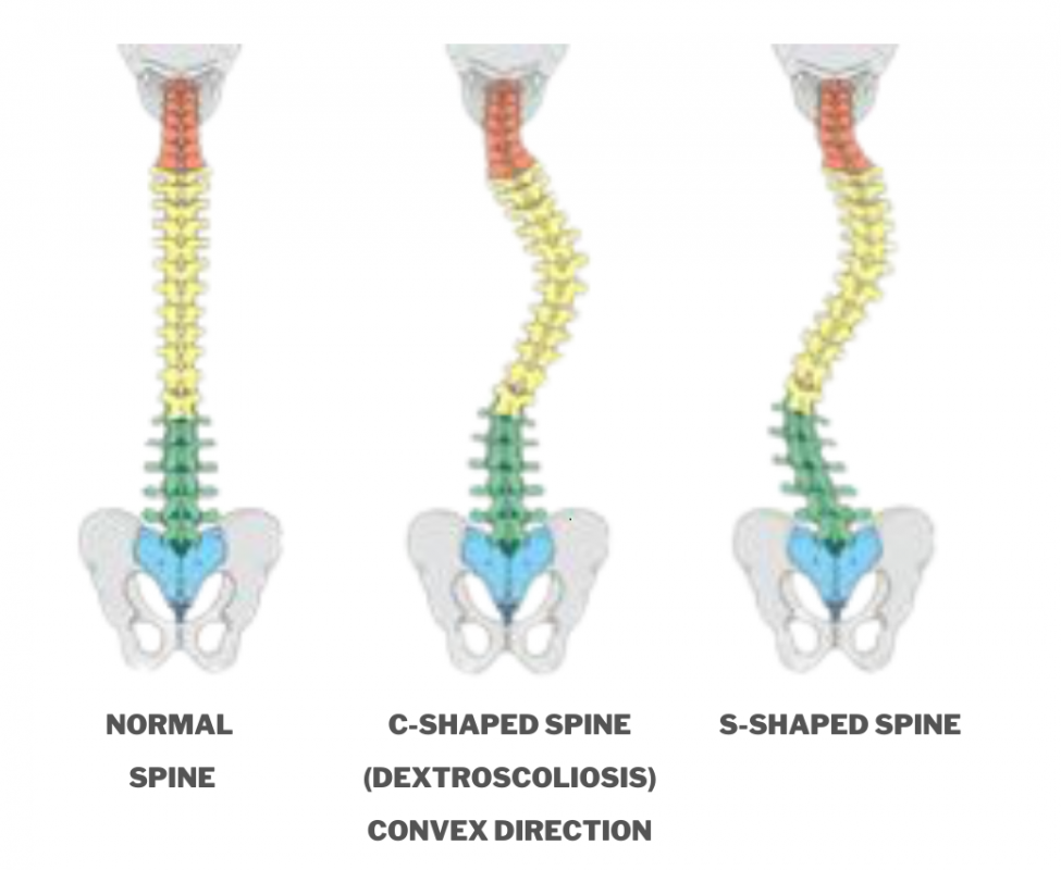 S shape