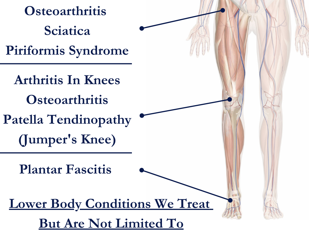Lower Body Diagram